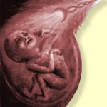 Die Abtreibungspille